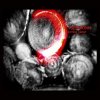 Bebhionn - Zombie Planet (2023) [FLAC]